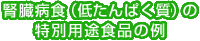 腎臓病食（低たんぱく質）の特別用途食品の例